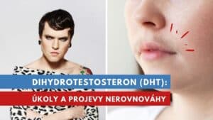 dihydrotestosteron