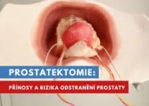 prostatektomie