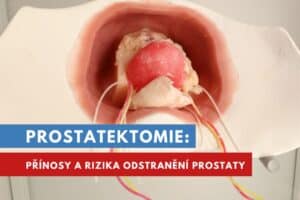 prostatektomie