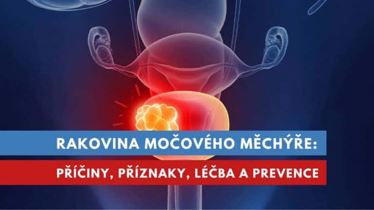 Rakovina Močového Měchýře Vzácná Ale Mnohdy Smrtelná Erekcecz 2923