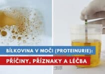 bílkovina v moči, proteinurie