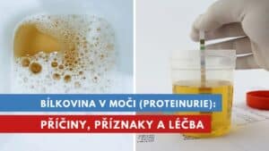 bílkovina v moči, proteinurie