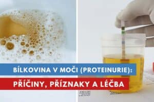 bílkovina v moči, proteinurie