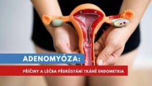 adenomyóza