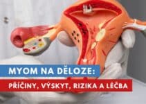 myom na děloze