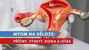 myom na děloze