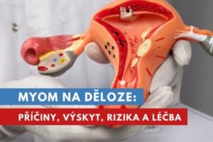 myom na děloze