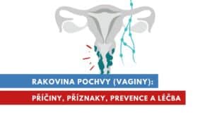 rakovina pochvy